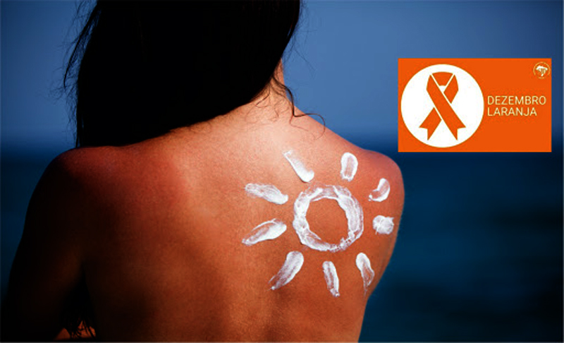 Além da proteção diária com o protetor solar, é importante ficar atento às pintas no corpo, tanto ao surgimento de novas manchas na pele ou alterações em manchas já existentes, como modificações de cor, tamanho ou assimetria