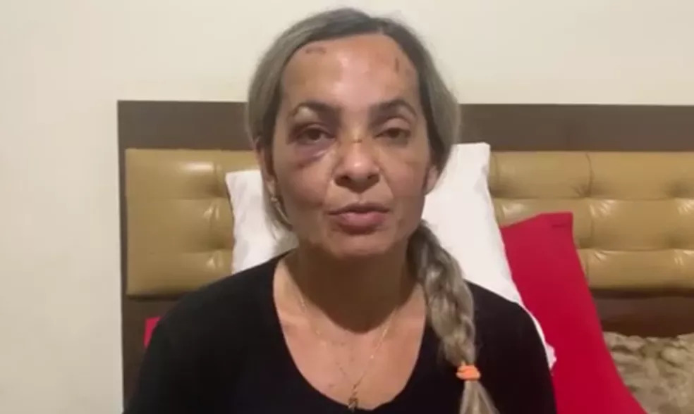 Fernanda Nogueira Teixeira, uma das sobreviventes do acidente que vitimou 7 pessoas na região dos campos gerais